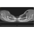 NewTom 7G VET